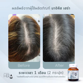[แพ็ค 2 กระปุก] Magicus Hera(มาจิคัส เฮร่า) เพื่อผู้มีปัญหาผมร่วง ผมบาง ศีรษะล้าน