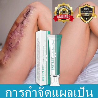 BREYLEE Scar Removal Gel 30g ครีมลดรอยแผลเป็น ลดผิวแตกลาย ลบรอยแผลเป็น ลดเลือนป้องกันรอยแผลเป็น