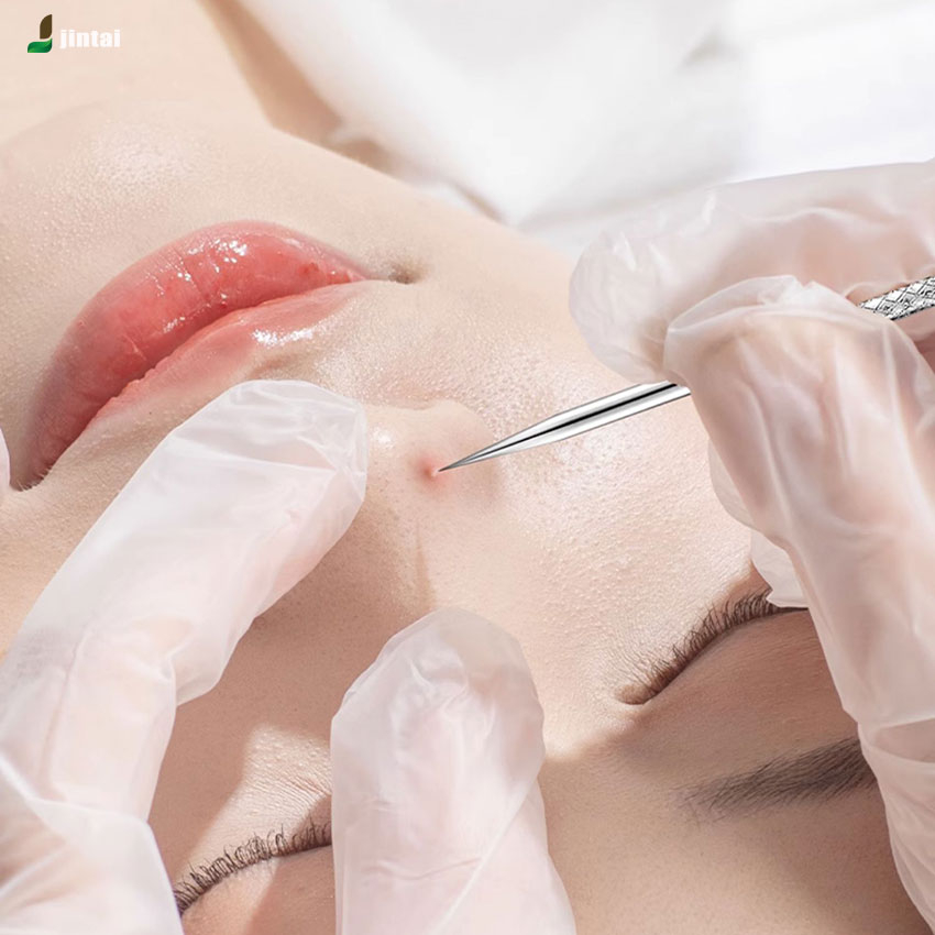 พร้อมส่ง ที่กดสิว ชุดกดสิว ไม้กดสิว แหนบดึงสิว อุปกรณ์กดสิว กำจัดสิวเสี้ยน สแตนเลสคุณภาพสูง ไม่เป็นสนิม ทนทาน แข็งแรง - รูปที่ 7