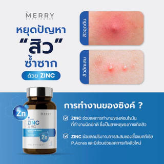 The Merry Zinc (Zinc Amino Acid Chelate 15 mg) วิตามินป้องกันการเกิดสิวและลดการอักเสบ : 30 Capsules