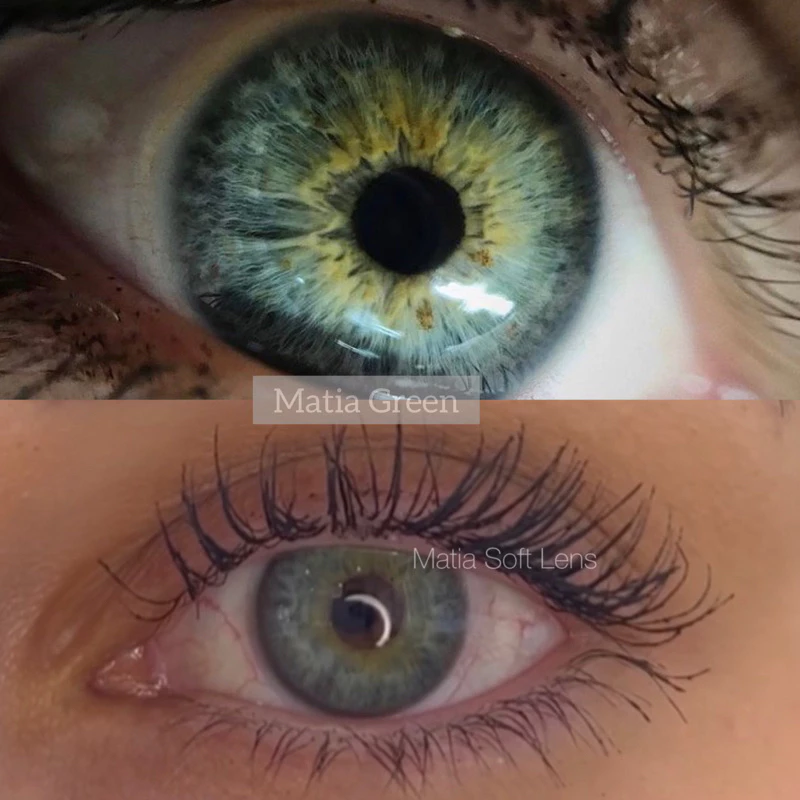 รุ่น Matia Green คอนแทคเลนส์สายฝอ (มีค่าสายตา)