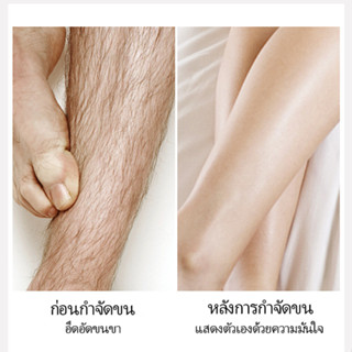 สเปรย์กำจัดขน   กำจัดขนมูส  กำจัดขนในร่างกาย  150ml  อ่อนโยนไม่ระคายเคือง  ไม่เจ็บผิว  กำจัดขนอย่างรวดเร็วและไม่เจ็