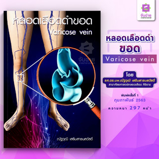 ตำราหลอดเลือดดำขอด Varicose Vein