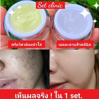 Tester🩸เซรั่มคลีนิก+ครีมแก้สิว รักษาทุกปัญหาสิวใน1set❗