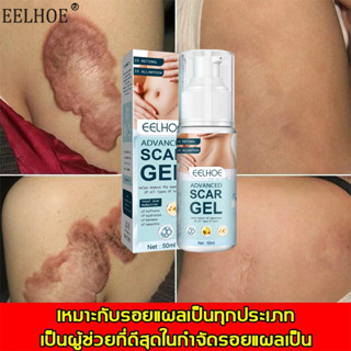 EELHOE ครีมลดรอยแผลเป็น 50ML ครีมทาแผลเป็น ครีมลดรอยสิว เจลลบรอยแผลเป็น ครีมลดแผลเป็น ครีมลบรอยแผลเป็น ครีมลบแผลเป็น