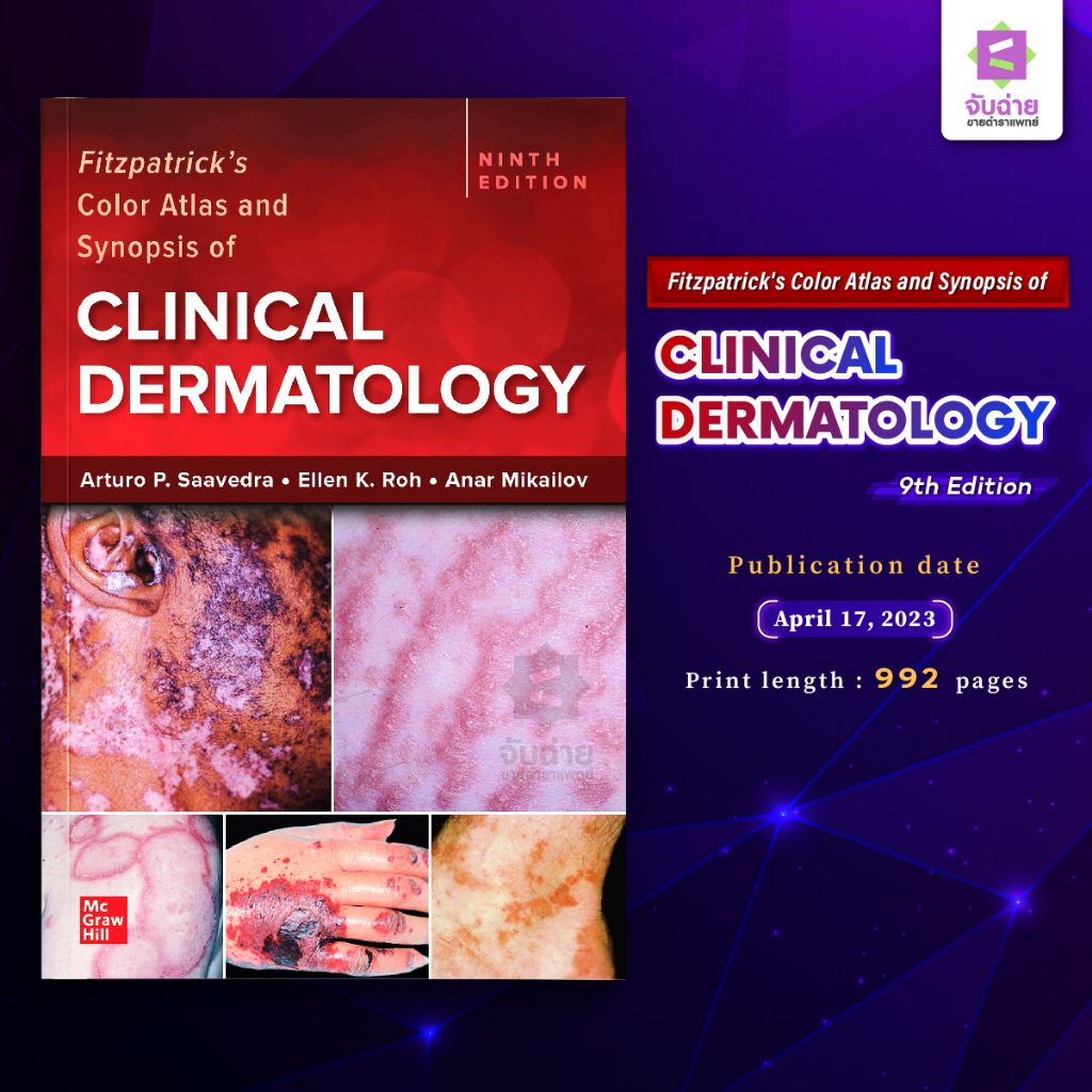 Fitzpatrick's Color Atlas and Synopsis of Clinical Dermatology 9th Edition