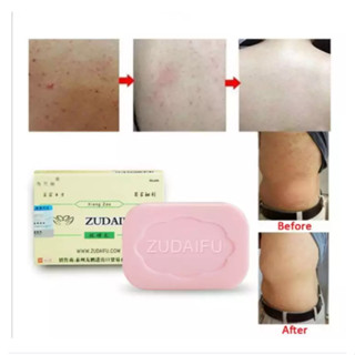 Zudaifu Sulfur Soap สบู่สมุนไพรธรรมชาติ 80 กรัม สบู่กำมะถัน สบู่ฆ่าเชื้อ ไล่ไร ล้างมือ ล้างหน้า อาบน้ำ บรรเทาอาการคัน