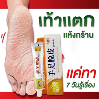 ครีมททเท้าแตก มือแตก มือด้าน ตาตุ่มด้าน เชื้อราที่เท้า ผิวแห้ง กร้าน