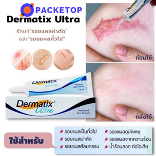 แท้ Dermatix Ultra Gel 15g เดอร์มาติกซ์ อัลตร้า เจล ครีมลดรอยแผลเป็น ครีมรักษาแผลเป็น ครีมลบรอยแผลเป็น ครีมทาแผลเป็น รักษารอยแผลเป็น