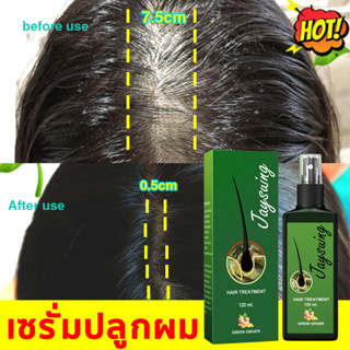 🔥ยาปลูกผมของแท้🔥เซรั่มปลูกผม 120ml ป้องกันผมร่วง บำรุงผม และบำรุงรากผม สเปรย์ปลูกผม น้ำยาปลูกผม ลดผมร่วง น้ำยาเร่งผมยาว