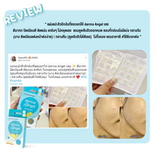 dermaAngel Salicyilc Acne patch for Day 12 ชิ้น 2 กล่อง