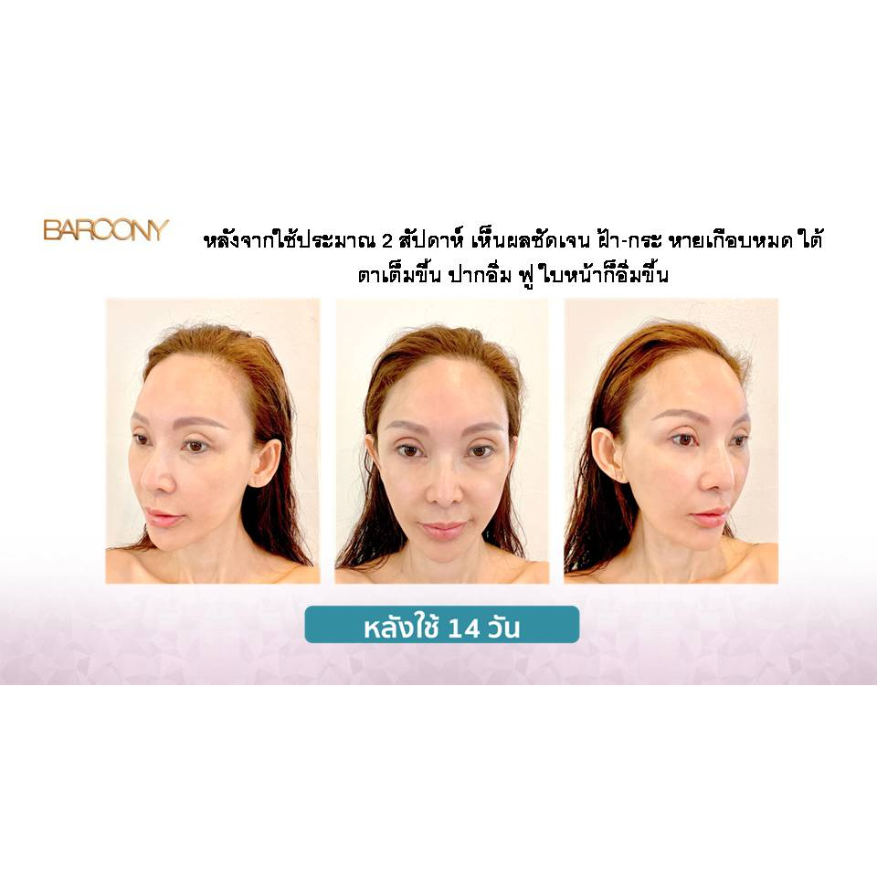 Barcony [3กระปุก] ครีมโสมเกาหลี โสม ครีมลดฝ้า กระ จุดด่างดำ ลดริ้วรอย จากเกาหลี - รูปที่ 7