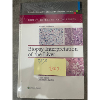 Biopsy Interpretation of the Liver