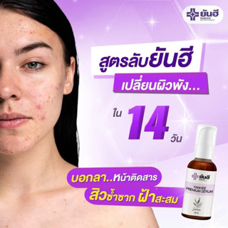 YANHEE PREMIUM SERUM “เซรั่มสูตรเฉพาะของโรงพยาบาลยันฮี