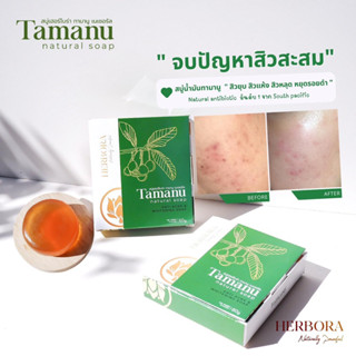 Tamanu Natural Soap สบู่ทามานู จบปัญหาสิว หน้าใสไร้สิว