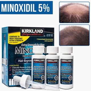 Kirkland 5%, Minoxidil Hair Loss เซรัม ผมร่วง หัวล้าน ปลูกผม ปลูกหนวด 60 Ml, 1 กล่อง (6 ขวด) สำหรับ พร้อมหลอดหยดแบบฝา