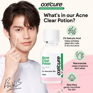 Oxecure ไอเท็มช่วยให้สิวยุบ หายไว บอกลาสิวผอด สิวอักเสบ ไม่ทิ้งรอยแผลเป็น