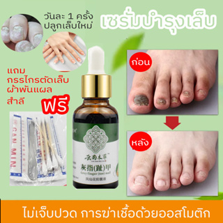 เซรั่มบํารุงเล็บ ครีมบํารุงเล็บ 30ml กำจัดเล็บพัง เล็บแตก เล็บเสียได้เร็ว ฆ่าเชื้อราที่เล็บ การฆ่าเชื้อด้วยออสโมติก