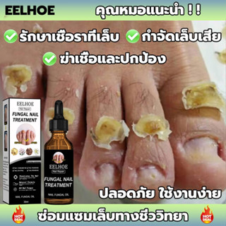 EELHOE เซรั่มซ่อมแซมเล็บ 50ml. กำจัดเล็บเสีย เชื้อราเล็บ เชื้อราที่เล็บ ฆ่าเชื้อราเล็บ ซ่อมแซมการติดเช .