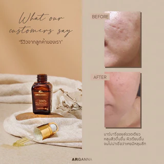 ARGANNA Barbary Fig Seed Oil น้ำมันบาร์บารี่บริสุทธิ์ 100% ลดริ้วรอย ฝ้า กระ