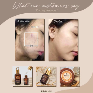 ARGANNA Rhassoul Moroccan Lava Clay ราซซูลโคลนลาวา มาสก์โคลน ทำความสะอาดผิว ลดสิว ผิวกระชับ