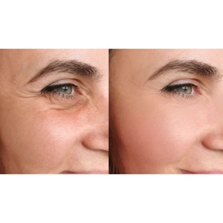 เซรั่ม Moisturizer สำหรับลดรอยเหียวย่น จุดด่างดำบนใบหน้า