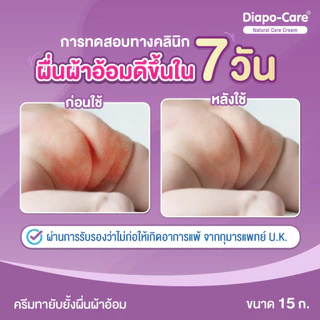 ไดโป-แคร์ เนเชอรัล แคร์ ครีม 15 ก. / DIAPO-CARE NATURAL CARE CREAM 15 G