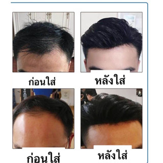 เสริมหน้าผาก ปิดผมบางผมแท้100%calawigs แผ่นชายติดหน้าผากแบบทากาว