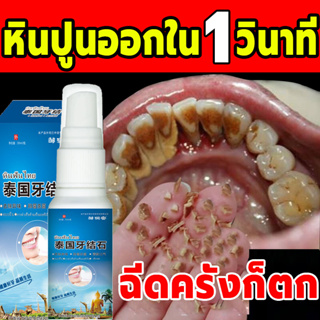 ยาสีฟันขจัดหินปูน 30ml กําจัดนิ่วในฟัน หินปูน น้ำยากำจัดหินปูน น้ำยากัดหินปูน ขจัดคราบหินปูน บรรเทาความลำ