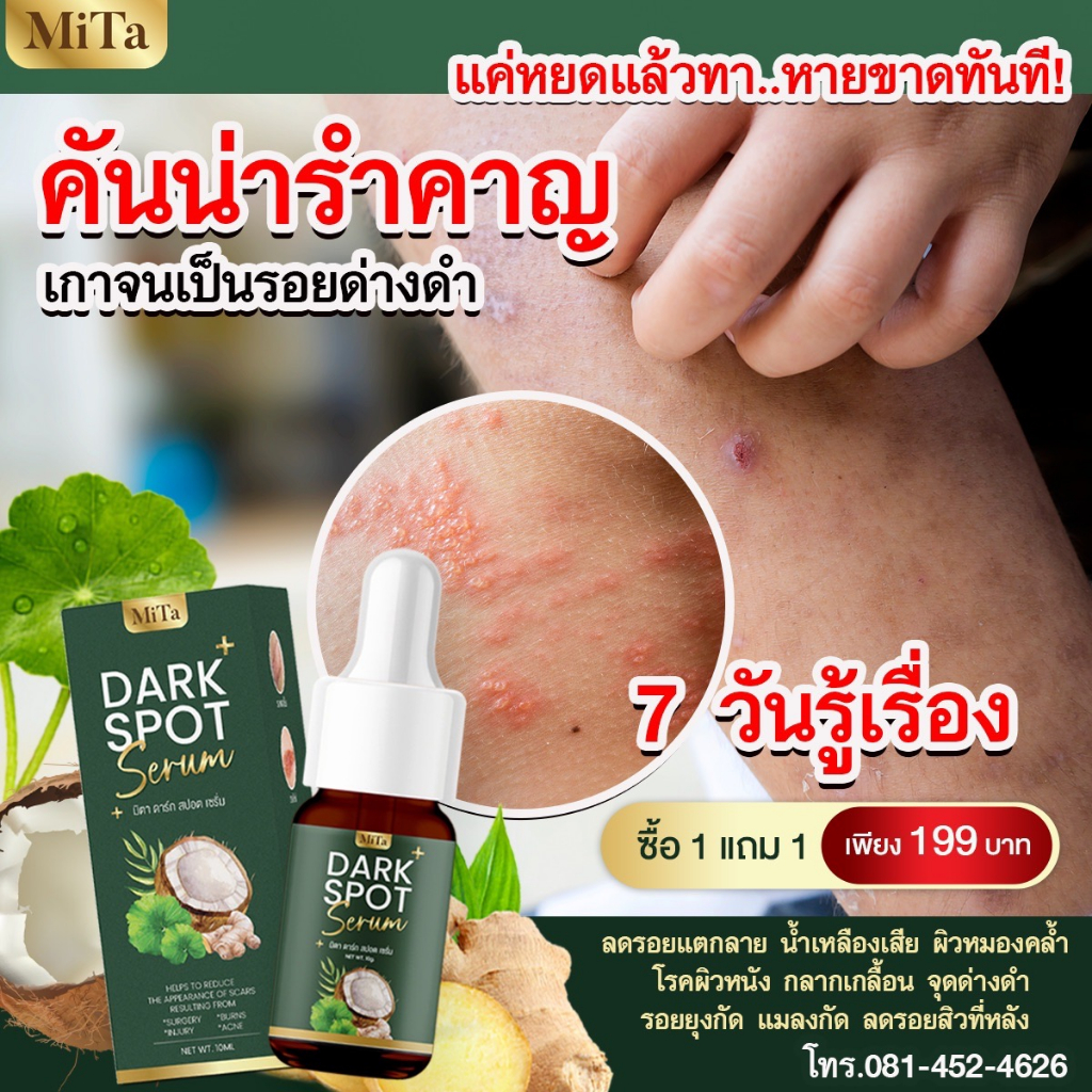 SERUM MITA *ส่งฟรี* ใช้ทารักษากลากเกลื้อน สะเก็ดเงิน คันผื่น ผิวเเห้ง เเพ้หเงื่อ สังคัง เริม เชื้อรา