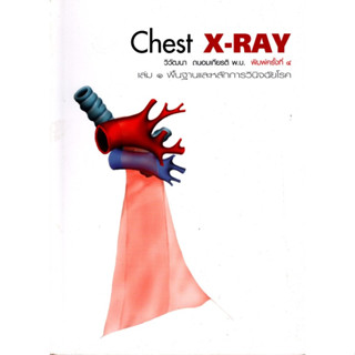 Chest X-Ray เล่ม 1 พื้นฐานและหลักการวินิจฉัยโรค