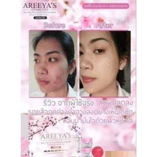 ครีมเซทอารียา​ Areeya’s​ Cosmetics​(