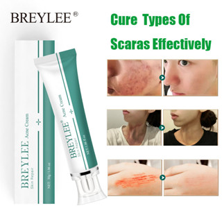 BREYLEE 30g ครีมลดรอยแผลเป็น ลดผิวแตกลาย ลบรอยแผลเป็น Scar Removal Gel แผลเป็น ใช้กับผิวหน้าและทุกส่วนของร่างกาย