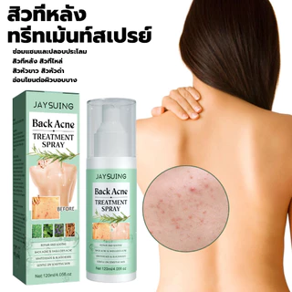 Jaysuing 120ml สิวที่หลัง แอคเน่ สเปรย์ฉีดแผ่นหลังและลำตัว ลดไรและสิวตามร่างกาย กำจัดสิวที่หลังและลำตัว ครีมแต้มสิว