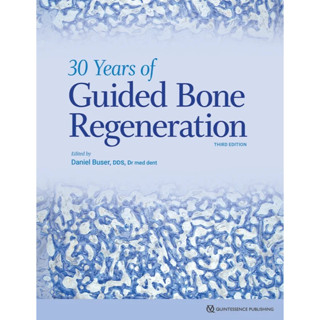 30 Years of Guided Bone Regeneration in Implant Dentistry (Hardcover)/Daniel Buser ISBN:9780867158038