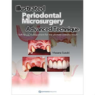 Illustrated Advanced Technique of Periodontal Microsurgery (Paperback)/Masana Suzuki ISBN:9784781209067