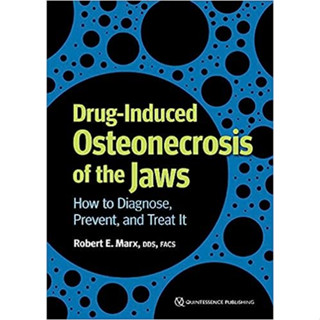 Drug-induced Osteonecrosis of The Jaws (Paperback)/Robert E. Marx ISBN:9781647240899