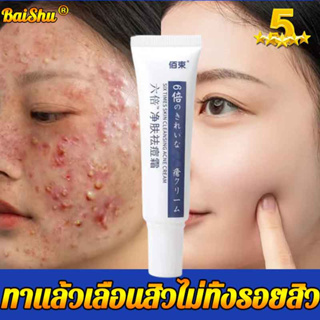 ครีมลดสิว  สิวอักเสบ มีประสิทธิภาพและเร็ว ไม่เป็นซ้ำ อ่อนโยน ปลอบประโลมและซ่อมแซม สิว สิว กำจัดสิว ครีมกำจัดสิว ครีมลดสิ