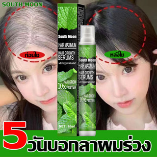 สเปรย์ปปลูกผม10ml เร่งผมงอกใหม่ บำรุงผม ฟื้นฟูผมแห้งเสีย บำรุงรากผม แตกปลาย สเปรย์ปลูกผม น้ำยาเร่งผมยาว เซรั่มปลูกผม