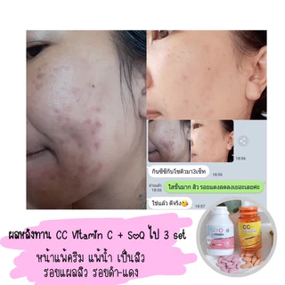 (ซื้อ1แถม1)กลูต้า1กระปุกแถมฟรีวิตามินซีลดสิว