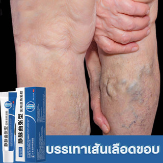 ⚡ Authentic ⚡ Blood heel Varicose veins Varicose veins cream Say goodbye to varicose veins The veins are clogged and painful.ส้นเลือดขอด ยาทาเส้นเลือดขอด ครีมทาเส้นเลือดขอด บอกลาเส้นเลือดขอด เส้นเลือดดำอุดตันและอาการปวดอย่างมีประสิทธิภาพ