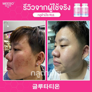 🍭มีโซ กลูต้า Meeso Gluta ผิวขาวออร่า ขาวสว่าง สิว ฝ้า กระ จุดด่างดำ  ขาวเร่งด่วน ขาวทั้งตัว 1 กระปุก 20 แคปซูล