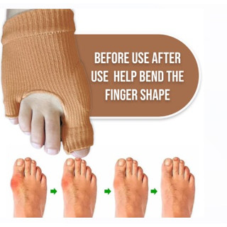 Bunion protection gel ผ้าสวมดัดนิ้วโก่ง***1 กล่องบรรจุ 1 คู่***