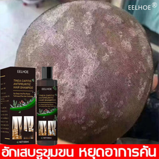 ยาขจัดรังแค100ml ยาสระผมแก้เชื้อรา ยาขจัดรังแค ยาสระผมรังแค คันศีรษะ ยาสระผมเชื้อรา แชมพูรักษารังแค shampoo