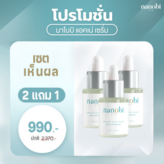 ส่งฟรี ✅ 2 แถม 1 ✅ นาโนบิ nanobi เซรั่ม สิว จากญี่ปุ่น สารสกัดวาซาบิ ธรรมชาติ ผิวหน้า ไม่แพ้ สิวหาย ไม่เกิดซ้ำ ลบรอยสิว