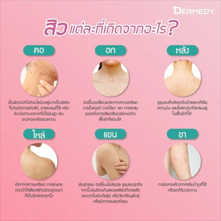 Dermedy Better Back Acne Spray 50ml เดอร์มีดี้ เบทเทอร์แบคแอคเน่สเปรย์ 50มล