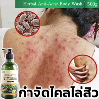 ครีมอาบน้ำ 500ml ขจัดไร ลบสิว พืชธรรมชาติ เจลอาบน้ำ ยับยั้งไร ป้อวกันสิวขึ้น  ชุ่มชื่นซ่อมแซมและบำรุง สิวบนหลัง