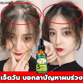 EELHOEขิงเซรั่มบำรุงผม ป้องกันผมร่วง 30ml แก้ปัญหาหัวล้าน น้ำยาปลูกผม เซรั่มผม หยุดผมร่วง น้ำยาเร่งผมยาว แชมพูปลูกผมดก