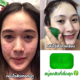 ของแท้✅| สบู่ใบบัวบกชาริยา สบู่ใบบัวบก สบู่ชาริยา สบู่ลดสิว ลดรอยสิว ลดจุดด่างดำ ล้างหน้าสะอาด สบู่หน้าใส สบู่ผิวขาว