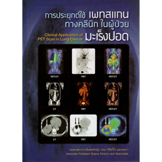 หนังสือ การประยุกต์ใช้เพทสแกนทางคลีนิกในผู้ป่วยมะเร็งปอด PET Scan in Lung Cancer รังสีวิทยา radiology oncology medicine